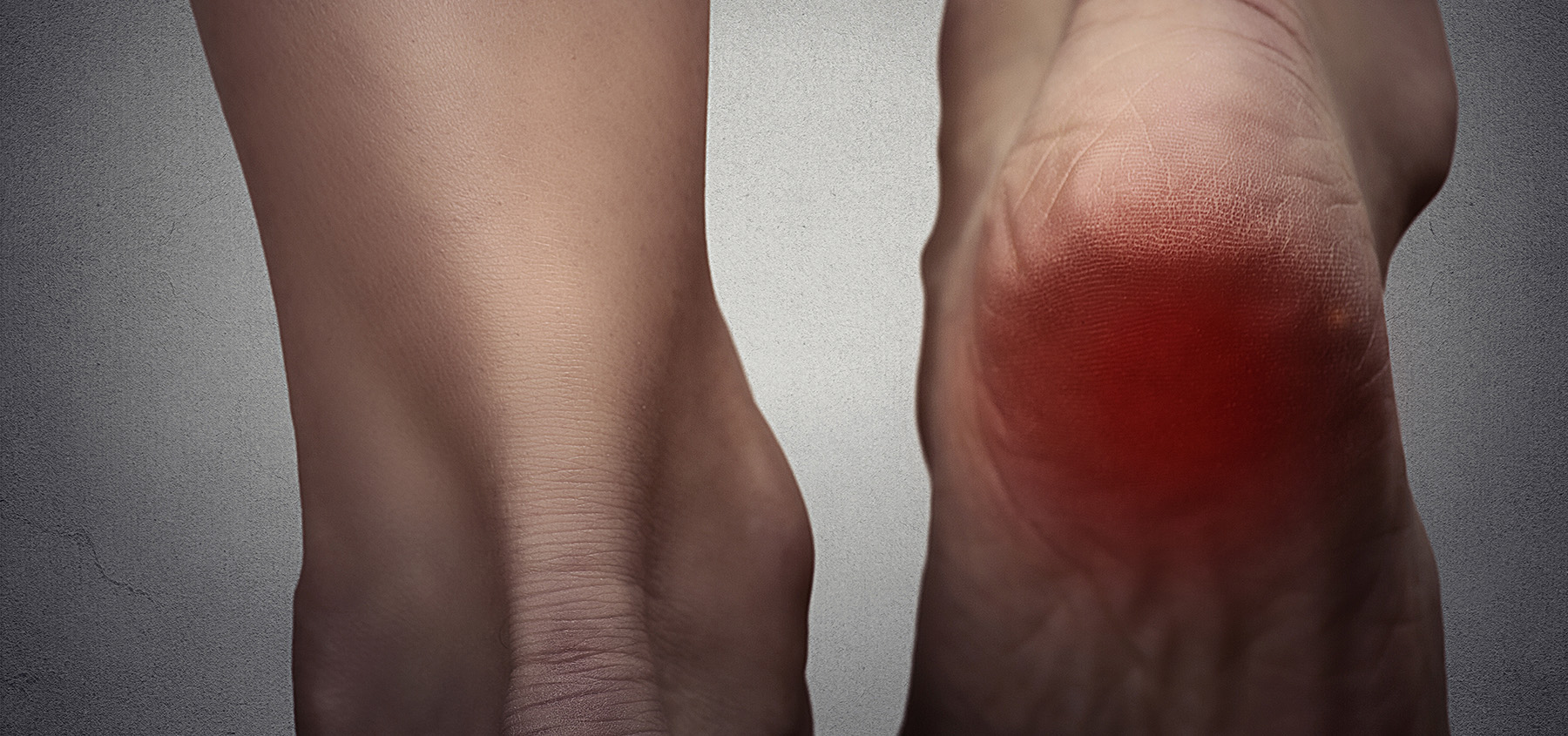 Female foot heel pain colored in red Advanced Foot & Ankle Centers of