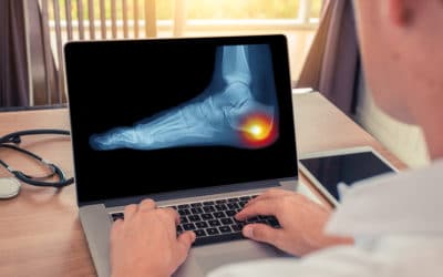 How Shockwave Therapy Can Put a Stop to Chronic Foot Pain