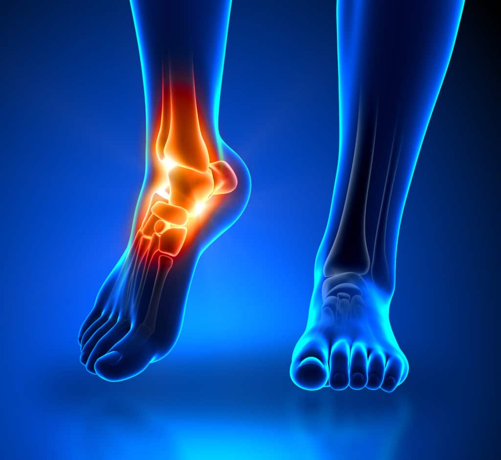 Foot and Ankle Arthritis // Advanced Foot & Ankle Centers of Illinois