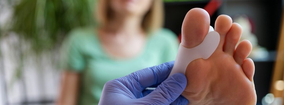 How Can I Treat My Bunion?