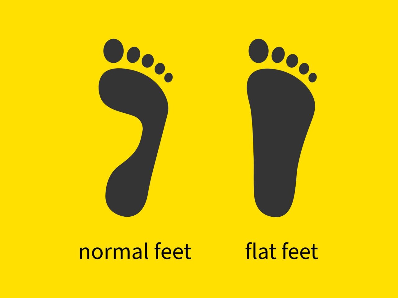 Running with Flat Feet? What You Should Know to Stay Injury Free