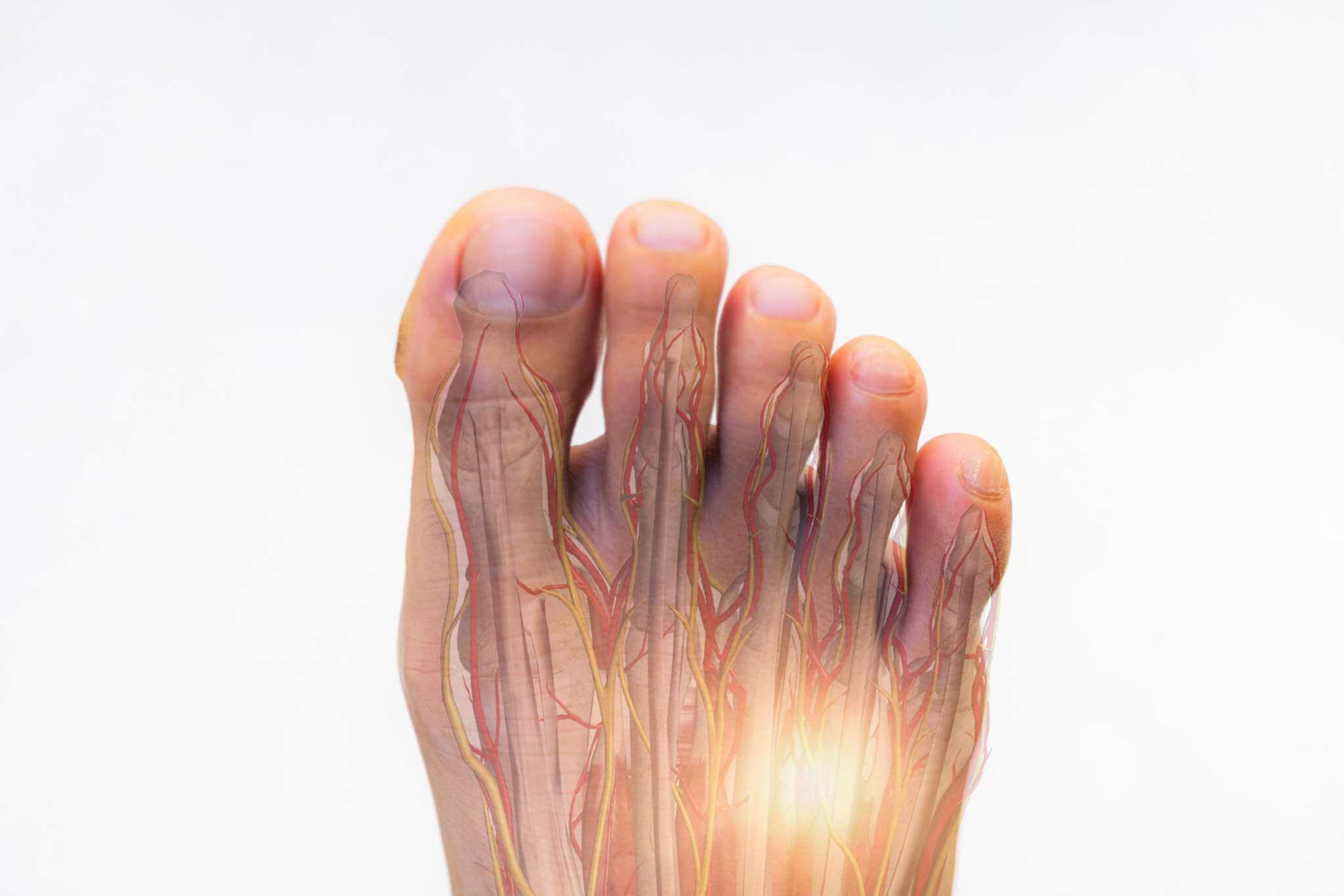 Orthopedic doctor or surgeon examined the patient with numbness of foot.Foot pain in Morton neuroma syndrome with transparent anatomy of nerve.Light effect on white background.Foot numbness and pain.