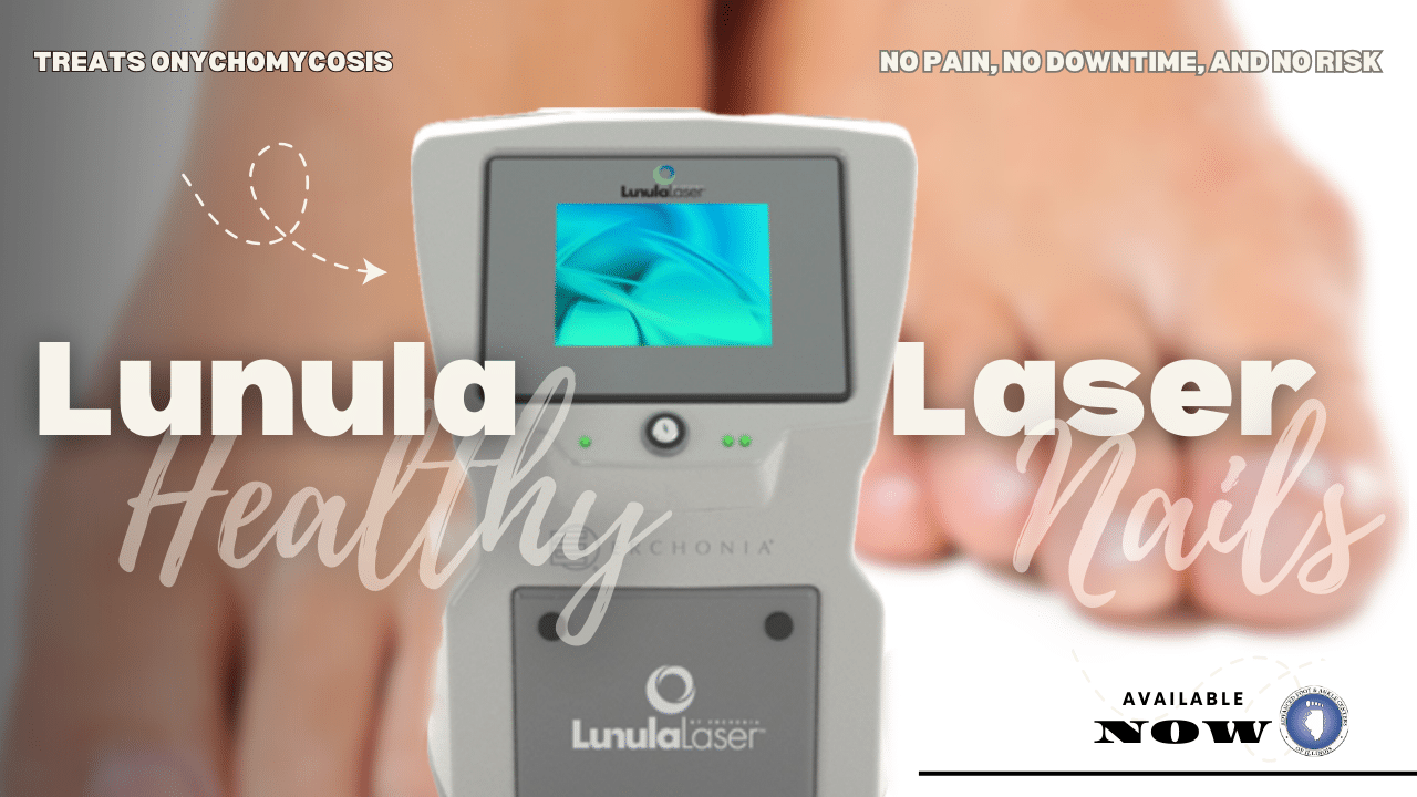 Lunula Laser
